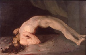 Opisthotonus in a patient suffering from tetanus - Painting by Charles Bell 1809