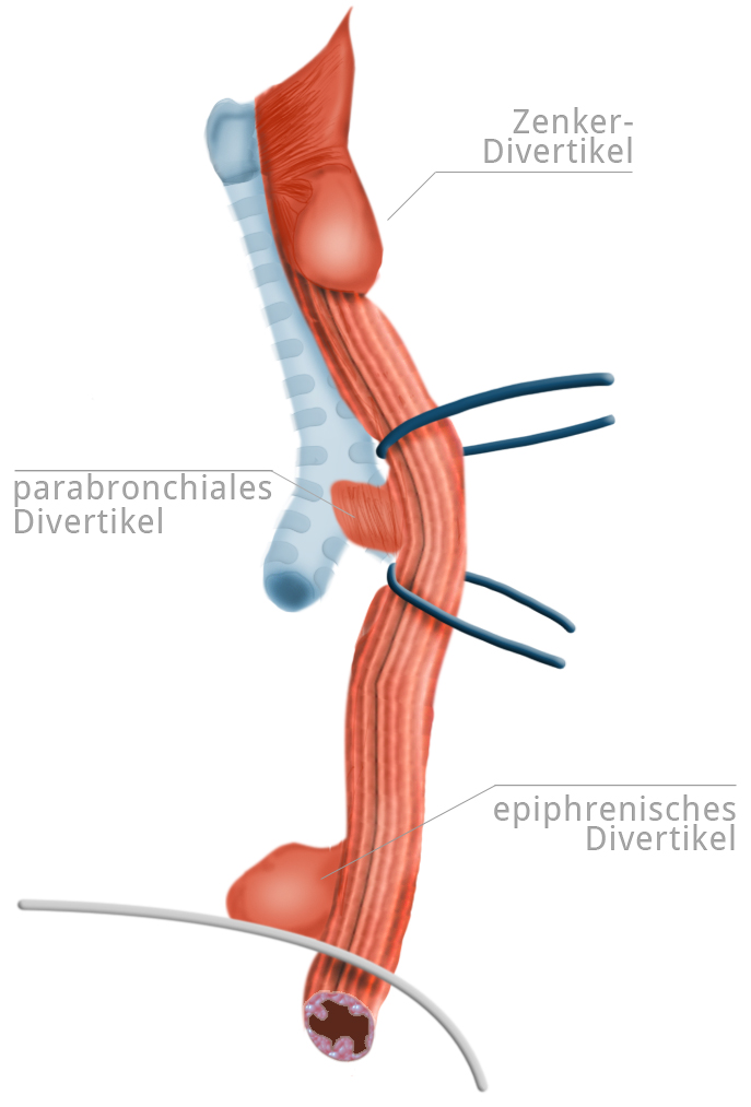 Anatomie Ösophagus