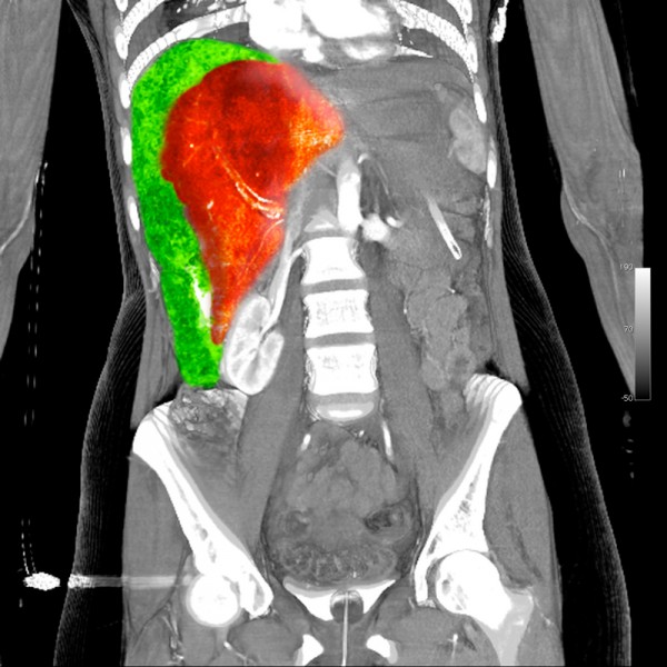 mySurgery Abdominaltrauma