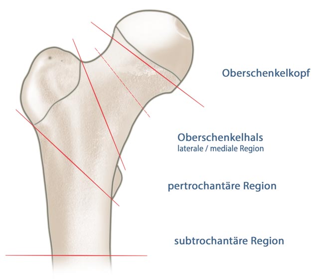 Oberschenkelkopf