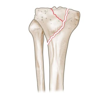 mySurgery | Unterschenkel