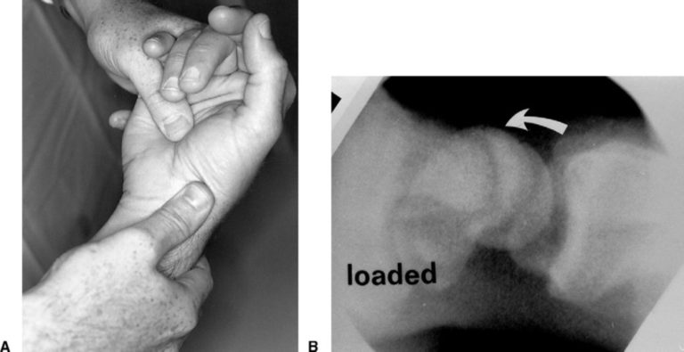 mysurgery | differenzialdiagnose chronischer