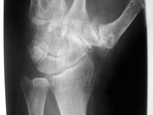 mysurgery | differenzialdiagnose chronischer