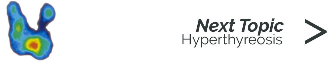 Hyperthyreose
